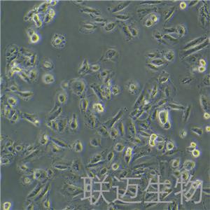 OS-RC-2细胞（肾癌细胞STR鉴定正确）LM8C0188