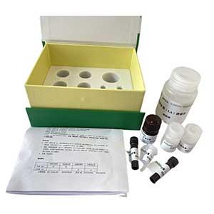 山梨醇氧化酶(SOX)测定试剂盒微板法/48样,SOX ELISA KIT