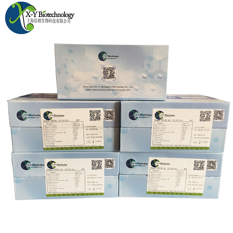 牛CCR1(C-C趋化因子受体1型)ELISA试剂盒,Bovine CCR1(C-C chemokine receptor type 1) ELISA Kit