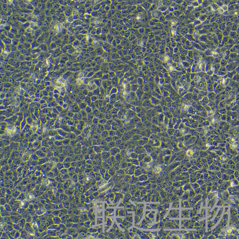 CAL27细胞（舌鳞癌细胞STR鉴定正确）LM8C0265,CAL27