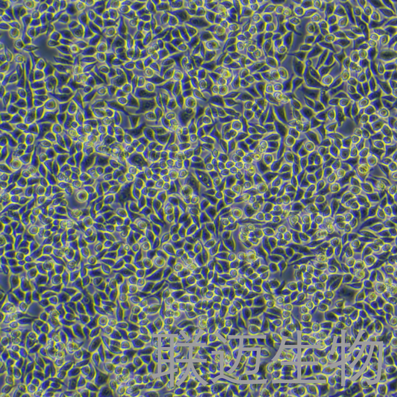 RKO细胞（结肠腺癌细胞STR鉴定正确）LM8C0199,RKO