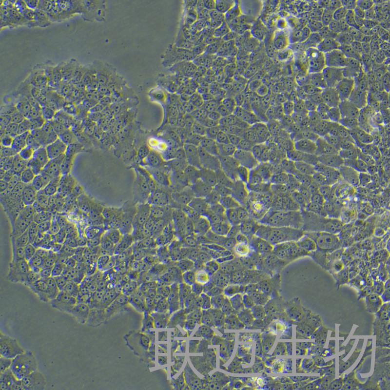 ZR-75-30细胞（乳腺癌细胞）LM8C0248,ZR-75-30