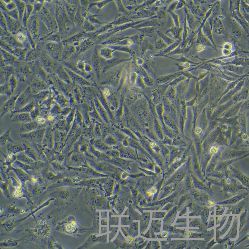 Saos-2细胞（成骨肉瘤细胞STR鉴定正确）LM8C0207,Saos-2