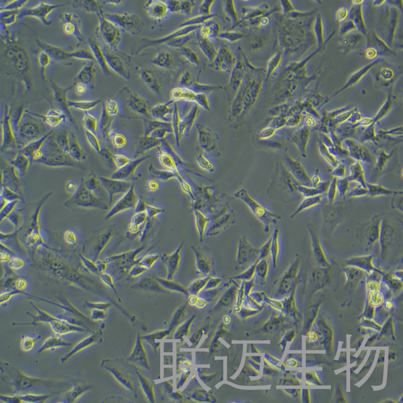 U-87MG细胞（脑星形胶质母细胞瘤细胞STR鉴定正确）LM8C0238,U-87MG