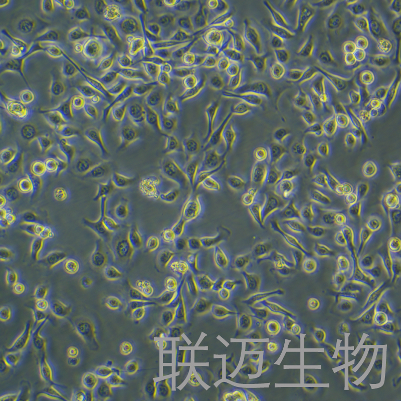TE-1细胞（食管癌细胞STR鉴定正确）LM8C0231,TE-1
