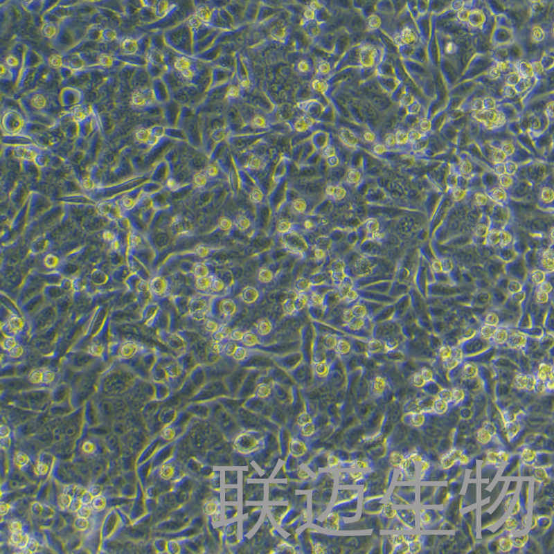 SW480[SW-480]细胞（结肠癌细胞STR鉴定正确）LM8C0227,SW480[SW-480]