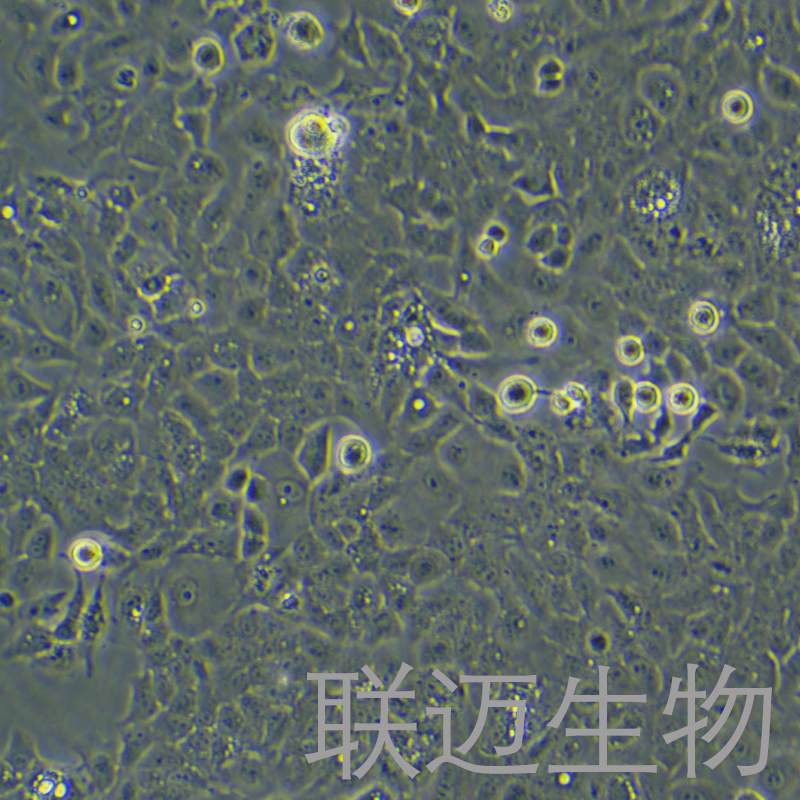 Ishikawa细胞（子宫内膜癌细胞STR鉴定正确）LM8C0283,Ishikawa