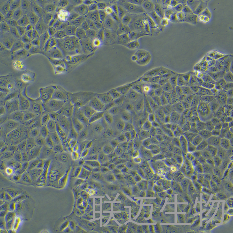 MKN-28细胞（胃癌高转移细胞）LM8C0291,MKN-28