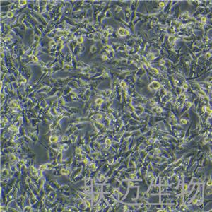 NCI-H1395细胞（肺腺癌细胞STR鉴定正确）LM8C0275