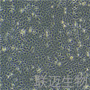 CAL27细胞（舌鳞癌细胞STR鉴定正确）LM8C0265