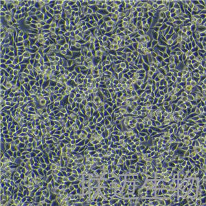 RKO细胞（结肠腺癌细胞STR鉴定正确）LM8C0199,RKO