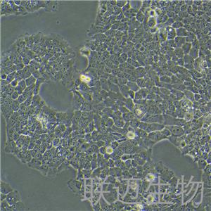 ZR-75-30细胞（乳腺癌细胞）LM8C0248,ZR-75-30