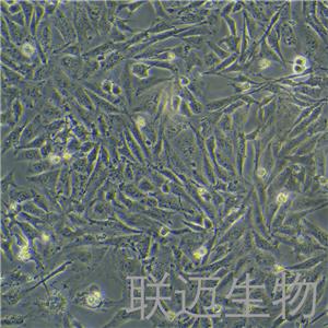 Saos-2细胞（成骨肉瘤细胞STR鉴定正确）LM8C0207