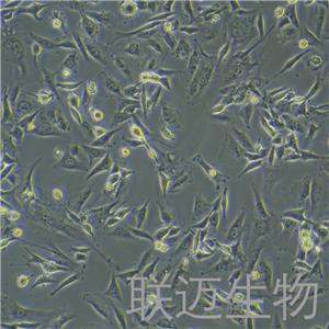 U-87MG细胞（脑星形胶质母细胞瘤细胞STR鉴定正确）LM8C0238,U-87MG