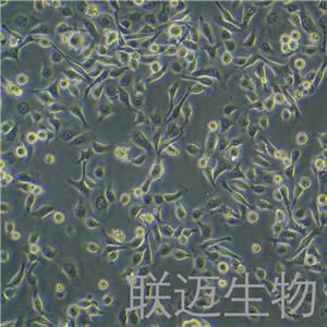 TE-1细胞（食管癌细胞STR鉴定正确）LM8C0231,TE-1