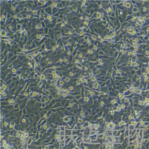 SW480[SW-480]细胞（结肠癌细胞STR鉴定正确）LM8C0227