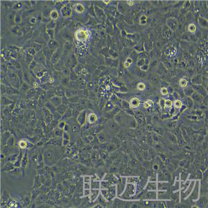 Ishikawa细胞（子宫内膜癌细胞STR鉴定正确）LM8C0283