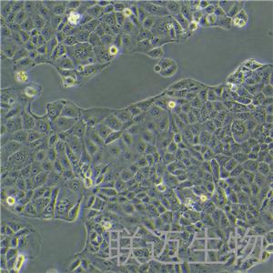 MKN-28细胞（胃癌高转移细胞）LM8C0291