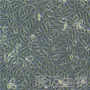 Caki-2细胞（肾透明细胞癌细胞）LM8C0326,Caki-2