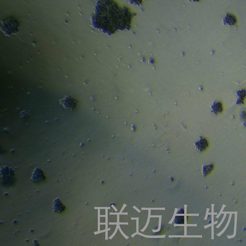 HuT78细胞（T淋巴细胞白血病细胞STR鉴定正确）LM8C0364,HuT78