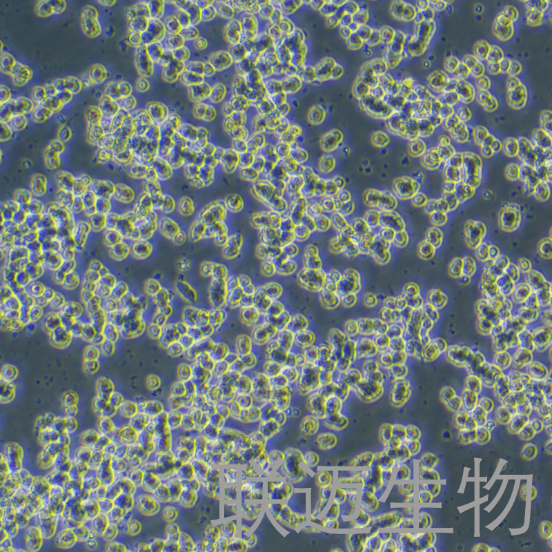 SK-NEP-1细胞（肾母细胞瘤细胞STR鉴定正确）LM8C0442,SK-NEP-1