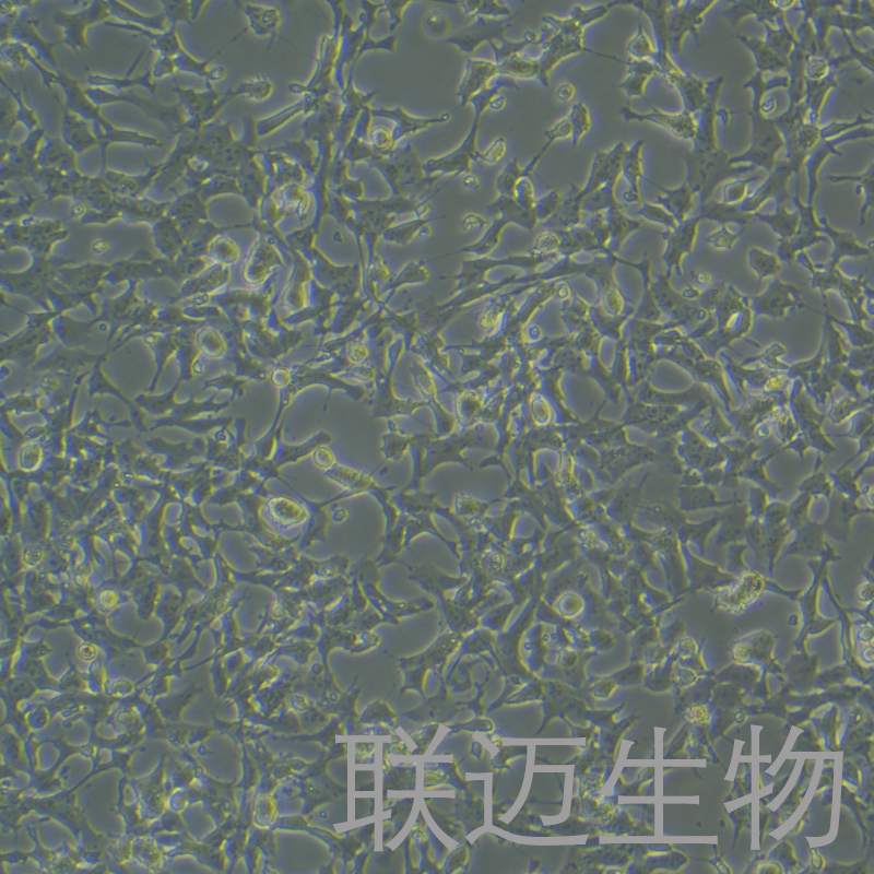 SK-N-MC细胞（神经上皮瘤细胞）LM8C0443,SK-N-MC