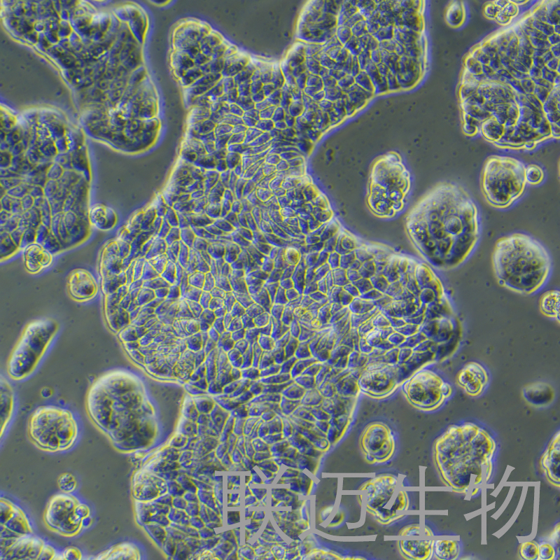 UACC-812细胞（乳腺导管瘤细胞）LM8C0461,UACC-812