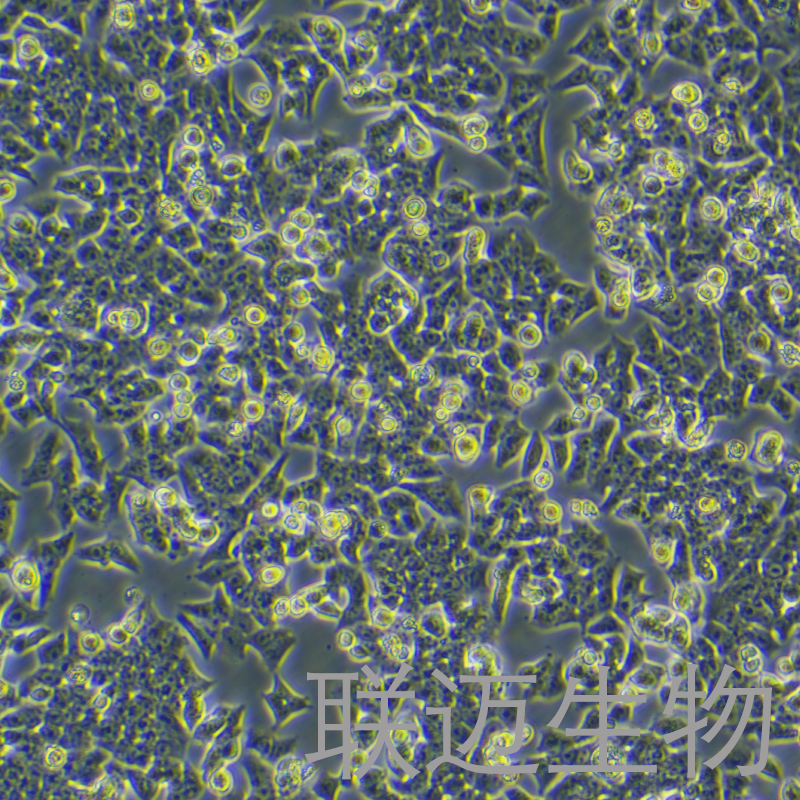 BIU-87细胞（膀胱癌细胞STR鉴定正确）LM8C0035,BIU-87