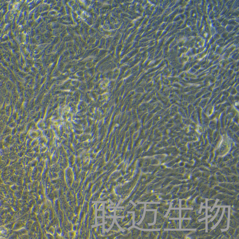 CFPAC-1细胞（胰腺癌细胞STR鉴定正确）LM8C0059,CFPAC-1