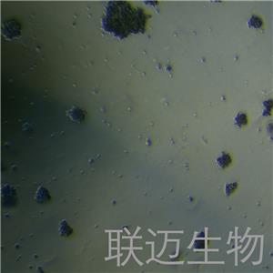 HuT78细胞（T淋巴细胞白血病细胞STR鉴定正确）LM8C0364