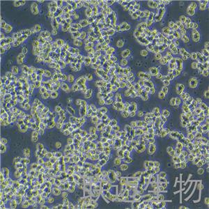 SK-NEP-1细胞（肾母细胞瘤细胞STR鉴定正确）LM8C0442