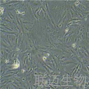 SW1353细胞（软骨肉瘤细胞STR鉴定正确）LM8C0447