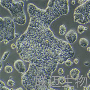 UACC-812细胞（乳腺导管瘤细胞）LM8C0461,UACC-812