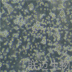 DT40细胞（鸡淋巴瘤细胞）LM8C0555,DT40