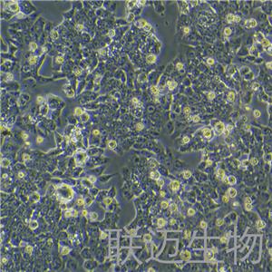 HCT116细胞（结肠癌细胞STR鉴定正确）LM8C0096