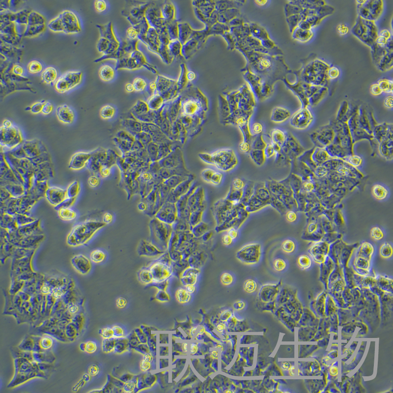 DLD-1细胞（结直肠腺癌上皮细胞STR鉴定正确）LM8C0074,DLD-1