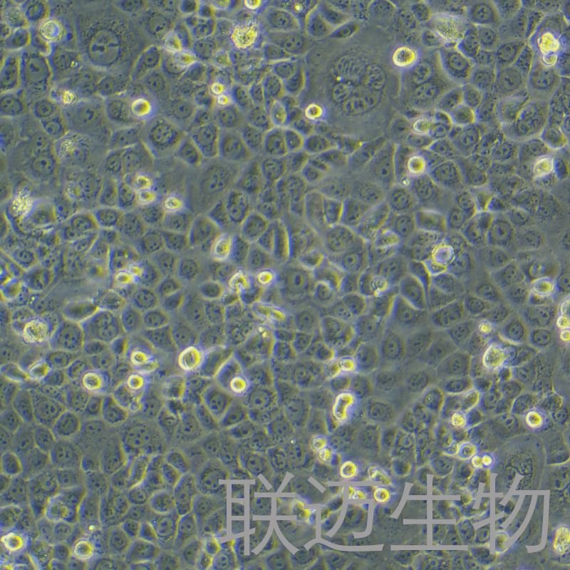 HCC1937细胞（乳腺癌细胞STR鉴定正确）LM8C0093,HCC1937