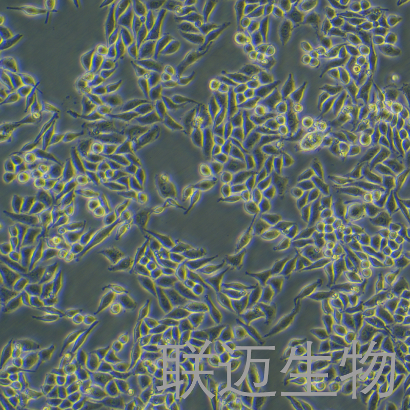 SiHa细胞（子宫颈鳞癌细胞STR鉴定正确）LM8C0210,SiHa