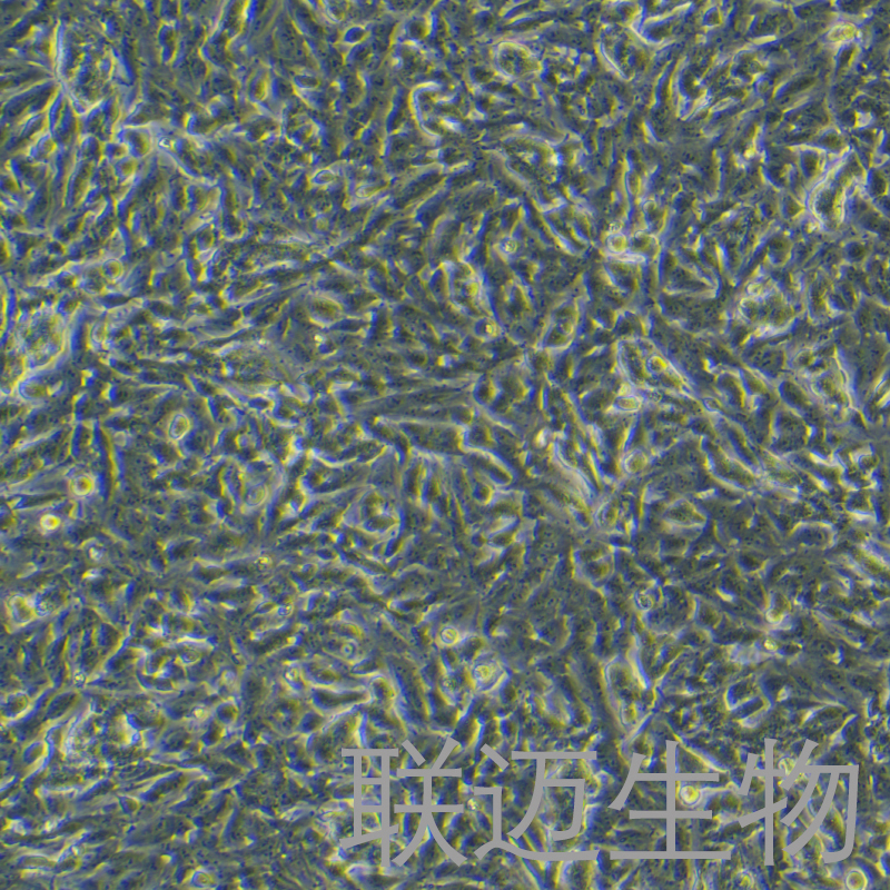 SH-SY5Y[SHSY-5Y]细胞（神经母细胞瘤细胞STR鉴定正确）LM8C0208,SH-SY5Y[SHSY-5Y]