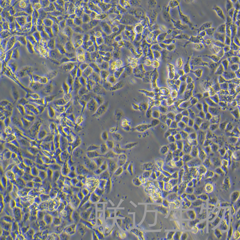 RL95-2细胞（子宫内膜癌细胞STR鉴定正确）LM8C0197,RL95-2