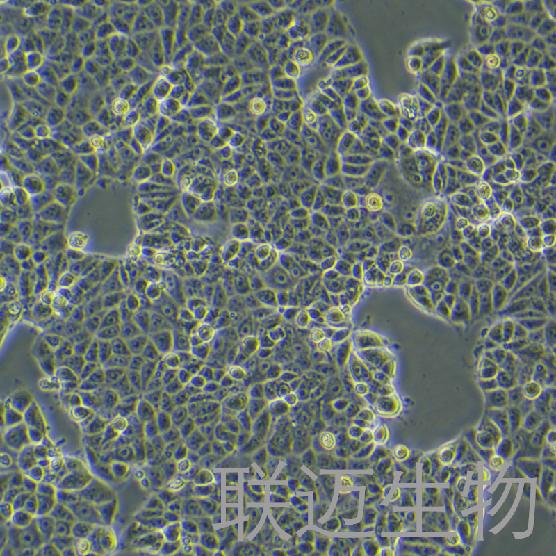 MCF7[MCF-7]细胞（乳腺癌细胞STR鉴定正确）LM8C0149,MCF7[MCF-7]