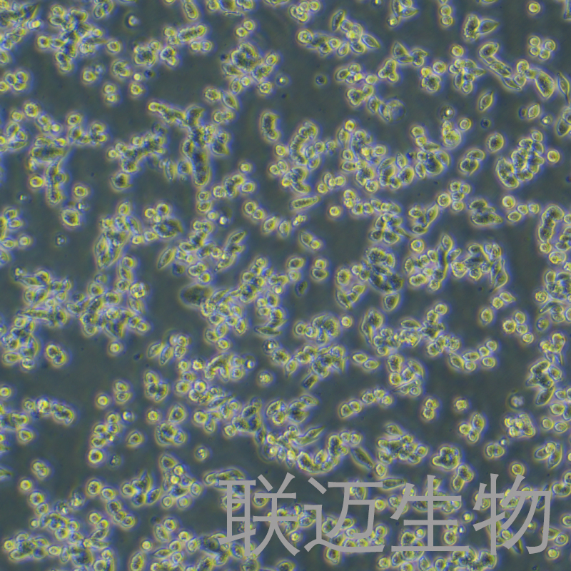 SW620细胞（结肠癌细胞STR鉴定正确）LM8C0225,SW620