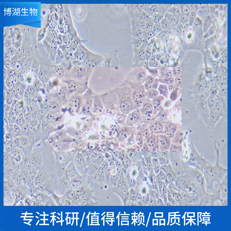 DU145人前列腺癌细胞,DU145