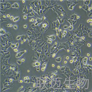 DLD-1细胞（结直肠腺癌上皮细胞STR鉴定正确）LM8C0074