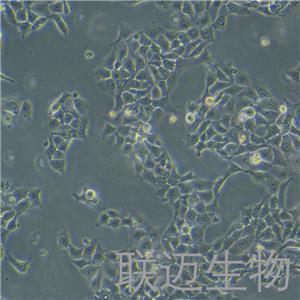 HCC827细胞（非小细胞肺癌细胞STR鉴定正确）LM8C0094