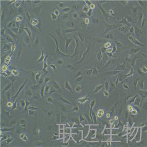 SK-OV-3细胞（卵巢癌细胞STR鉴定正确）LM8C0215