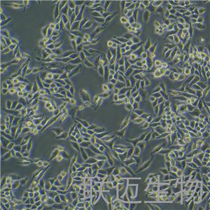 SiHa细胞（子宫颈鳞癌细胞STR鉴定正确）LM8C0210,SiHa