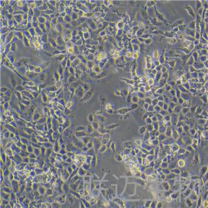 RL95-2细胞（子宫内膜癌细胞STR鉴定正确）LM8C0197,RL95-2