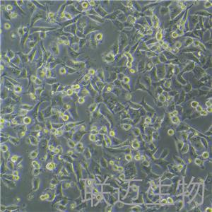 PANC-1细胞（胰腺癌细胞STR鉴定正确）LM8C0184