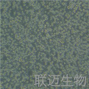 Jurkat,CloneE6-1细胞（T淋巴细胞白血病细胞STR鉴定正确）LM8C0129